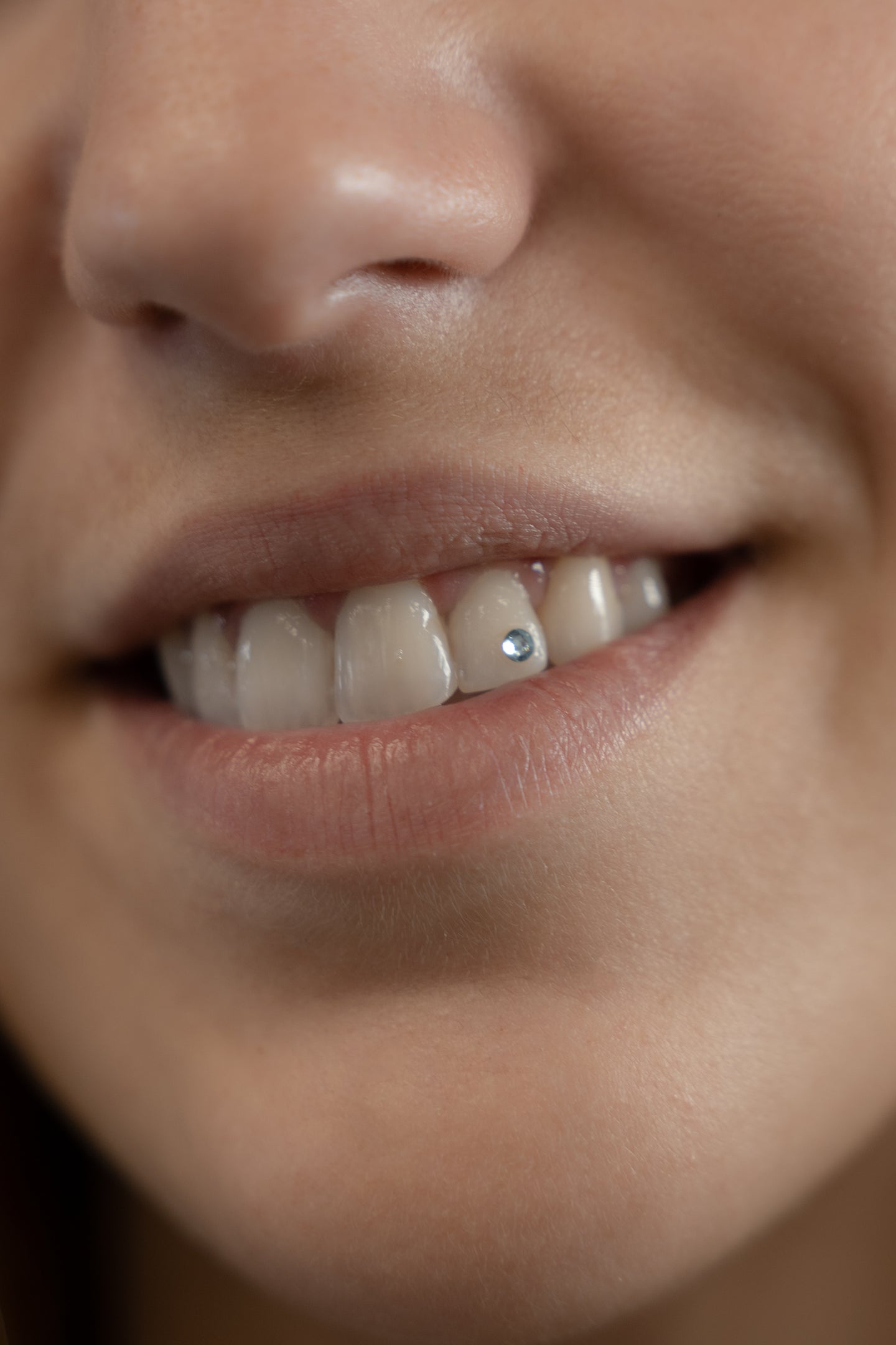 Toothgems deposit 30€